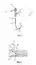 Fig. 02 - Positioning system for manipulating a channel within a medical device