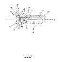Fig. 04 - Positioning system for manipulating a channel within a medical device