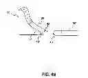 Fig. 05 - Positioning system for manipulating a channel within a medical device