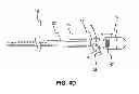 Fig. 07 - Positioning system for manipulating a channel within a medical device