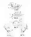 Fig. 10 - Positioning system for manipulating a channel within a medical device