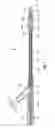Fig. 02 - Apparatus and methods for treating obstructions within body lumens