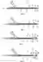 Fig. 03 - Apparatus and methods for treating obstructions within body lumens