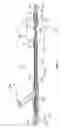 Fig. 05 - Apparatus and methods for treating obstructions within body lumens