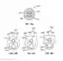 Fig. 09 - Apparatus and methods for treating obstructions within body lumens