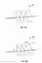 Fig. 12 - Apparatus and methods for treating obstructions within body lumens