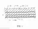 Fig. 02 - Methods and kits for volumetric distribution of pharmaceutical agents via the vascular adventitia and microcirculation
