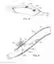 Fig. 09 - Methods and kits for volumetric distribution of pharmaceutical agents via the vascular adventitia and microcirculation