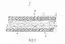 Fig. 02 - Three-dimensional apertured film for transmitting dynamically-deposited and statically-retained fluids