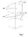 Fig. 08 - Method for producing a disposable incontinence diaper with contoured diaper side parts