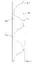 Fig. 09 - Method for producing a disposable incontinence diaper with contoured diaper side parts