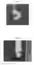 Fig. 03 - Delivery of materials into margins of tissue cavities