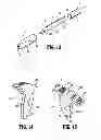 Fig. 07 - Surgical Device for Pediatric Surgery