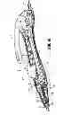 Fig. 08 - Surgical Device for Pediatric Surgery