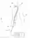 Fig. 01 - INTRAVASCULAR NERVE ABLATION DEVICES & METHODS
