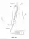 Fig. 09 - INTRAVASCULAR NERVE ABLATION DEVICES & METHODS