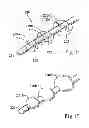 Fig. 08 - Irrigated catheter