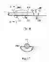 Fig. 09 - Irrigated catheter