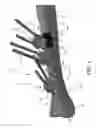 Fig. 02 - Multi-axis adjustable splint