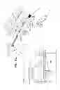 Fig. 47 - Arthroscopic surgical device