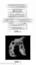 Fig. 02 - Methods and Compositions for Articular Repair