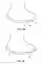 Fig. 06 - Methods and Compositions for Articular Repair