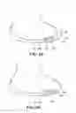 Fig. 08 - Methods and Compositions for Articular Repair
