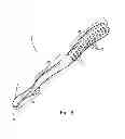 Fig. 04 - Surgical guide instrument and system for ACL reconstruction and method of using same