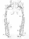 Fig. 05 - Surgical guide instrument and system for ACL reconstruction and method of using same