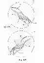 Fig. 06 - Surgical guide instrument and system for ACL reconstruction and method of using same