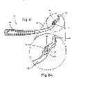 Fig. 07 - Surgical guide instrument and system for ACL reconstruction and method of using same
