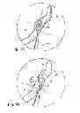 Fig. 09 - Surgical guide instrument and system for ACL reconstruction and method of using same