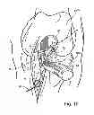 Fig. 12 - Surgical guide instrument and system for ACL reconstruction and method of using same
