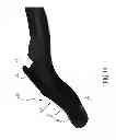 Fig. 16 - Surgical guide instrument and system for ACL reconstruction and method of using same