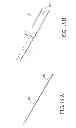Fig. 17 - Surgical guide instrument and system for ACL reconstruction and method of using same