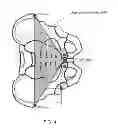 Fig. 05 - METHOD AND APPARATUS FOR DETERMINING THE ORIENTATION AND/OR POSITION OF AN OBJECT DURING A MEDICAL PROCEDURE