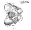 Fig. 06 - METHOD AND APPARATUS FOR DETERMINING THE ORIENTATION AND/OR POSITION OF AN OBJECT DURING A MEDICAL PROCEDURE