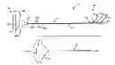 Fig. 01 - Device and method for delivering a curable material into bone