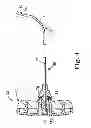 Fig. 06 - Device and method for delivering a curable material into bone
