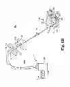 Fig. 09 - Device and method for delivering a curable material into bone