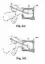 Fig. 12 - Device and method for delivering a curable material into bone