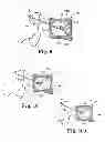 Fig. 13 - Device and method for delivering a curable material into bone