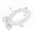 Fig. 02 - OVOID TUNNEL GUIDE AND METHOD OF ACL RECONSTRUCTION