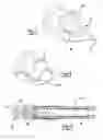 Fig. 04 - Ear pressure equalizing tube and insertion device