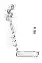 Fig. 02 - Specimen retrieval device