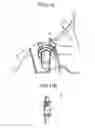 Fig. 30 - Surgical clip applier methods