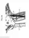 Fig. 32 - Surgical clip applier methods
