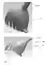 Fig. 27 - Left atrial appendage treatment systems and methods