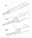 Fig. 02 - Suture clip deployment devices