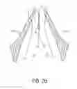 Fig. 28 - Suturing devices and methods for suturing an anatomic valve